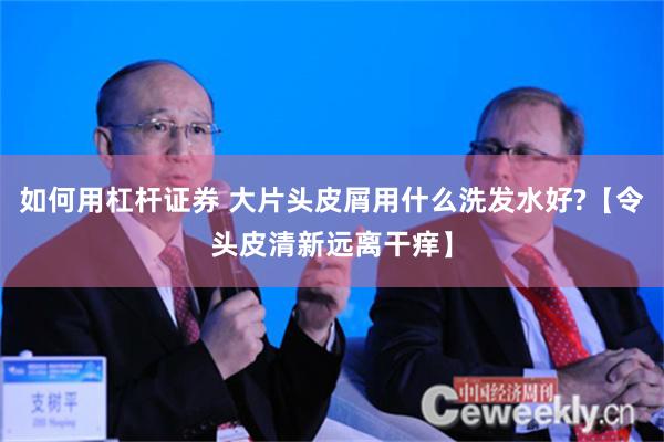 如何用杠杆证券 大片头皮屑用什么洗发水好?【令头皮清新远离干痒】